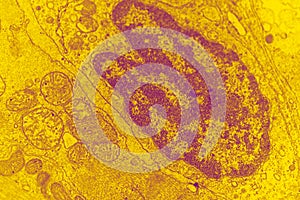 Electron micrograph of a cell nucleus