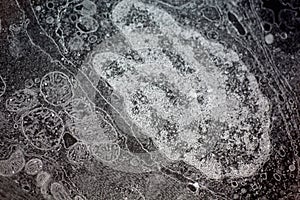 Electron micrograph of a cell nucleus