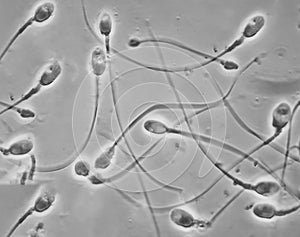 Electron micrographs of human sperm cells.