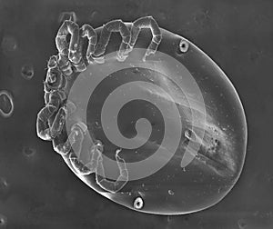 Electron microscope-mite photo