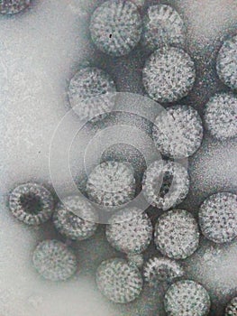 Electron microscopy of rotavirus particles photo