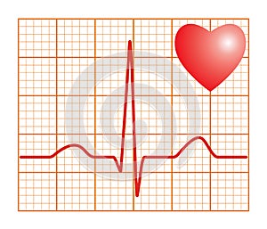 Electronic cardiogram ECG heart beat