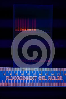 Electrophoregram of DNA separation