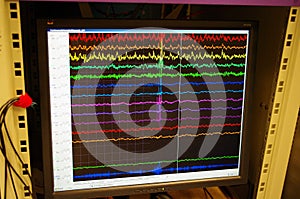 Electrophysiological setup in the research lab with recorded ongoing EEG to register activity of neurons, neuronal ensembles and