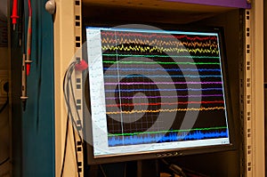 Electrophysiological setup in the research lab with recorded ongoing EEG to register activity of neurons, neuronal ensembles and