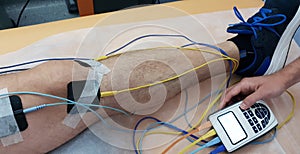 Electrostimulation of the quadriceps as a physiotherapy