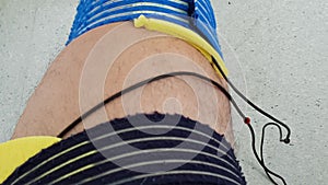 Electrostimulation of the quadriceps as a physiotherapy therapy