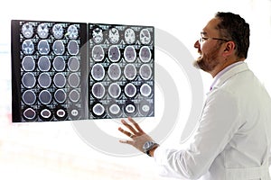 Elegant, light-eyed mature medical man with beard, mustache and glasses, analyzing x-ray brain scans