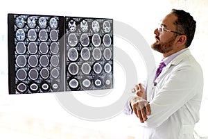 Elegant, light-eyed mature medical man with beard, mustache and glasses, analyzing x-ray brain scans