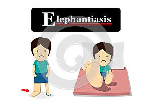 Elephantiasis in flat cartoon, vector photo
