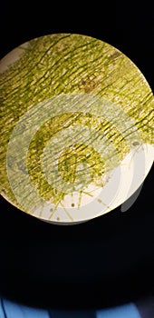 Elodea Canadiensis under Microscope photo