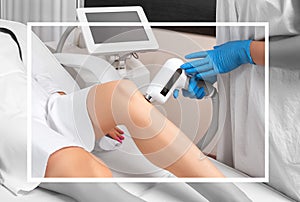 Elos epilation hair removal procedure on a womans body. Beautician doing laser rejuvenation on the lower leg