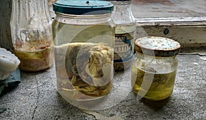 Embryo in the laboratory in Pripyat