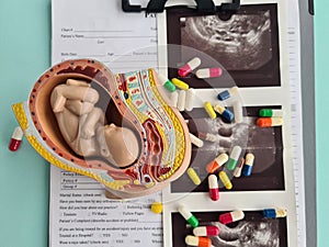 Embryo model fetus and medicine and medical pills