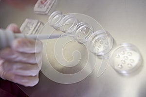 Embryologist preparing cultures photo