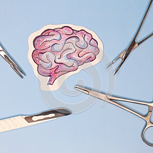 emergency surgery on human brain. pencil drawing.