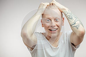 Emotional overjoyed surprised Albino male model with bugged eyes and open mouth.