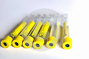 Empty tubes for blood or urine tests.