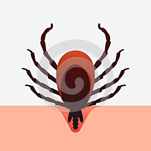 Encephalitis mite bites through human skin