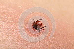 Encephalitis tick