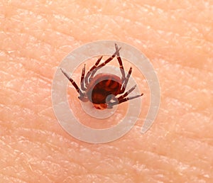 Encephalitis tick