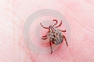 Encephalitis Virus or Lyme Disease Infected Tick Arachnid Insect on Skin