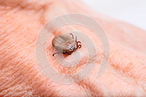 Encephalitis Virus or Lyme Disease or Monkey Fever Infected Tick Arachnid Insect on Skin