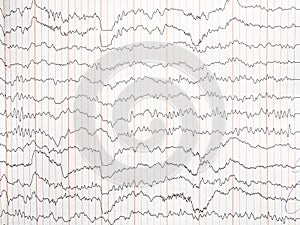 encephalogram on paper, trace of activity of brain