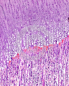 Endochondral ossification. Growth plate