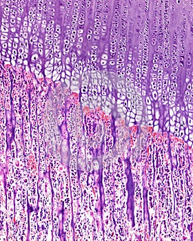 Endochondral ossification. Growth plate