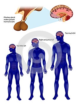 Endocrine regulation of growth. Pituitary gland makes growth hormone GH. Growth hormone or somatotropin, also known as