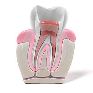 Endodontics - root canal procedure