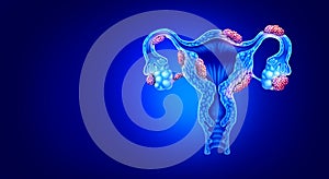 Endometriosis Disease Concept