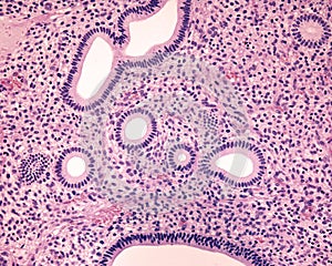 Endometrium. Proliferative phase photo