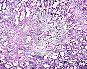 Endometrium. Secretory phase