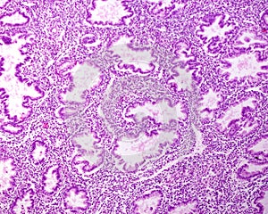 Endometrium. Secretory phase