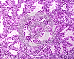 Endometrium. Secretory phase