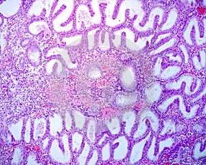 Endometrium. Secretory phase