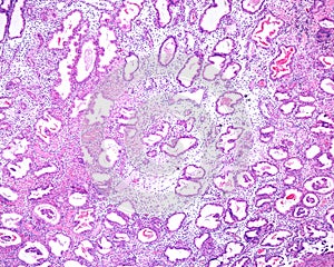 Endometrium. Secretory phase photo