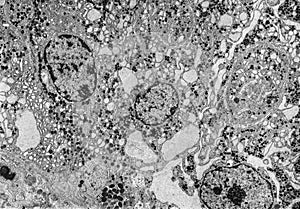 Endoplasmic reticulum