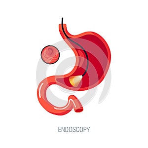 Endoscopy diagnostic,  concept in flat style