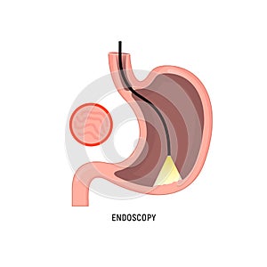 Endoscopy logo icon. Stomach gastroscopy cartoon gastritis medicine sign cancer egd system icon.