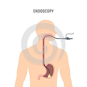 Endoscopy stomach anatomy equipment vector illustration. Esophagus endoscope body exam, gastroscopy human instrument