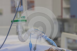 Endotracheal  tube, HME filter, carbon dioxide sensor,  patient connected to medical ventilator in ICU in hospital