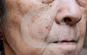 Enlarged pores in face of Asian, elder woman with skin folds