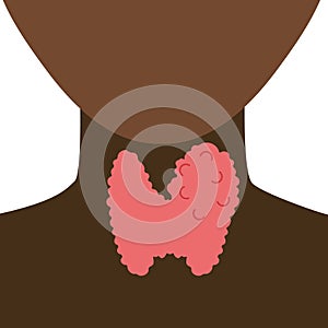 Enlarged thyroid gland on black neck silhouette