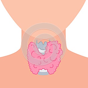 Enlarged thyroid gland on neck silhouette diagram