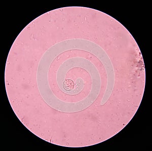 Entamoeba coli cyts potozoa