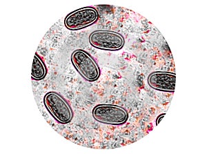 Enterobius vermicularis (EV) eggs. parasite in stool, image under light microscopy.