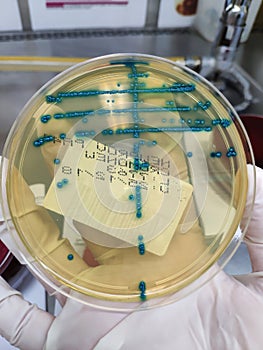 Enterococcus faecalis. urine culture on chromogenic agar photo